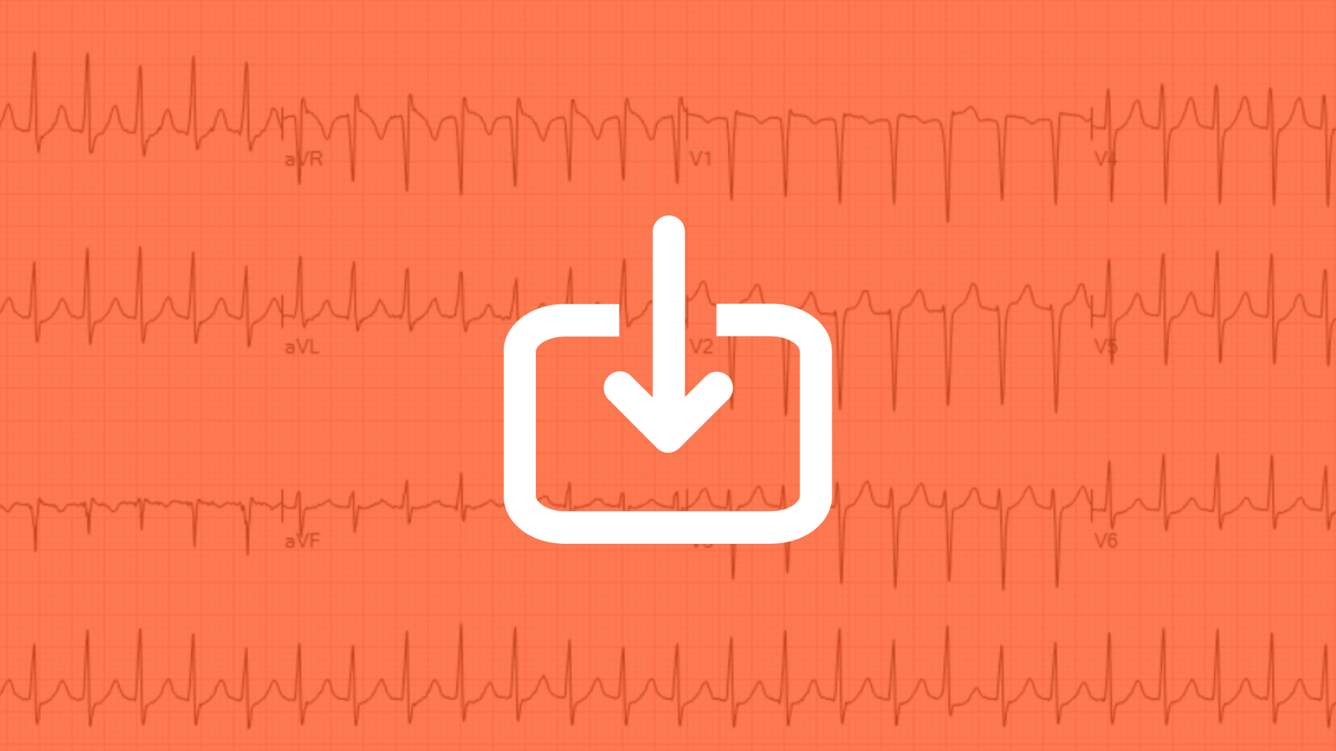 Importa gli ECG in AlfaDocs.