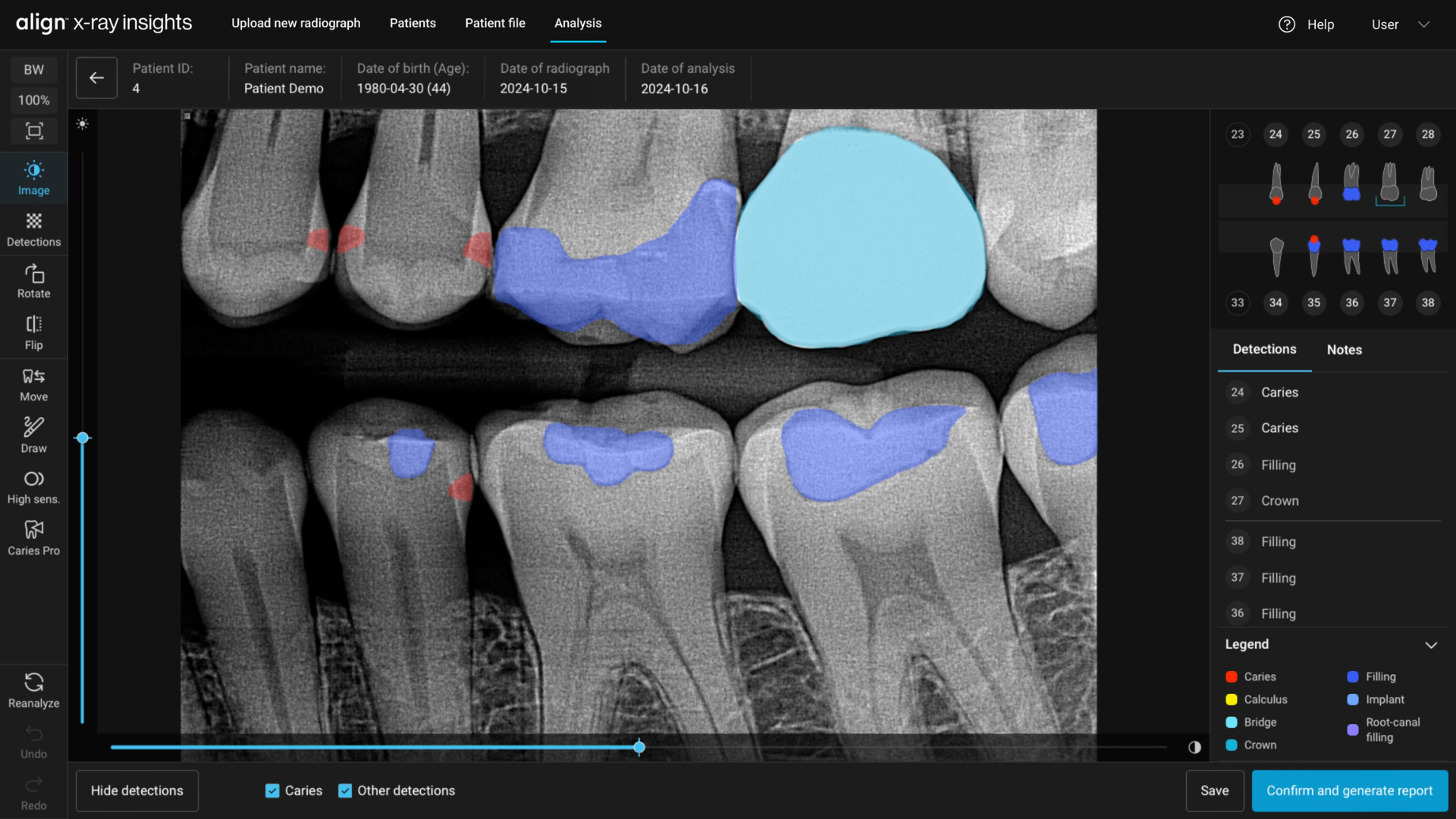 Automatizza l'analisi delle radiografie con l’intelligenza artificiale.