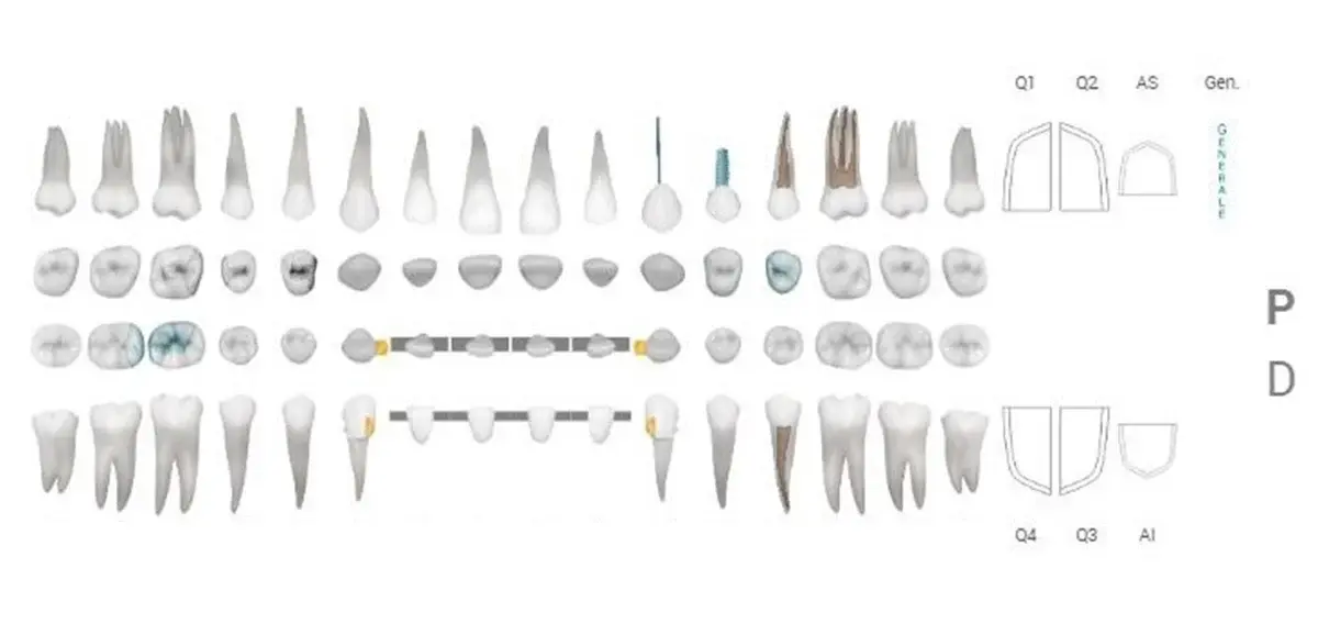 odontogramma con sezioni+ PD